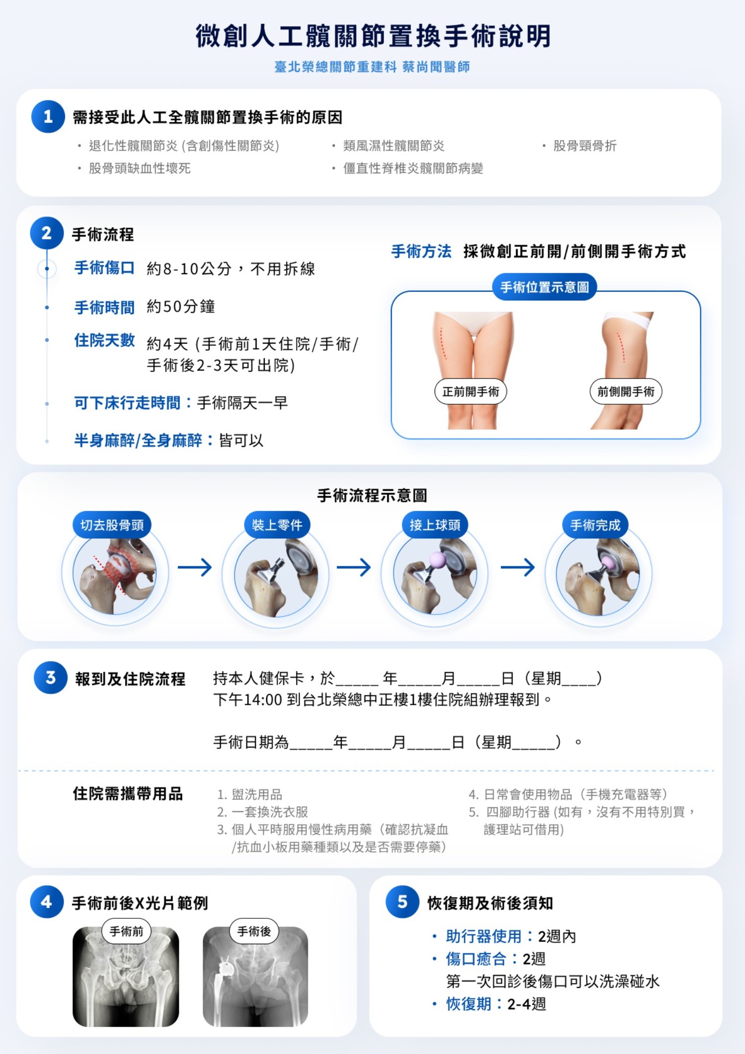 人工髖關節置換術