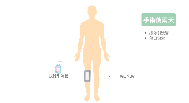 高位脛骨截骨矯正手術-術後兩天