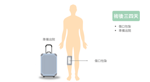 高位脛骨截骨矯正手術-術後三四天出院