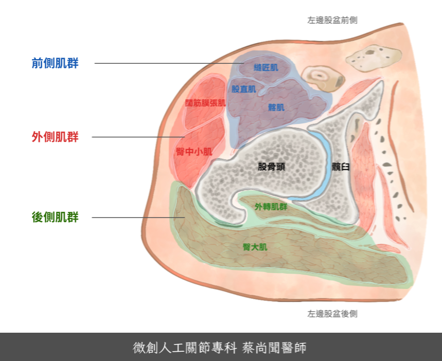 正前開髖關節手術-蔡尚聞