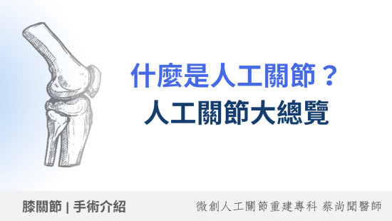 什麼是人工關節？進行人工關節手術之前，大家都想知道的事！