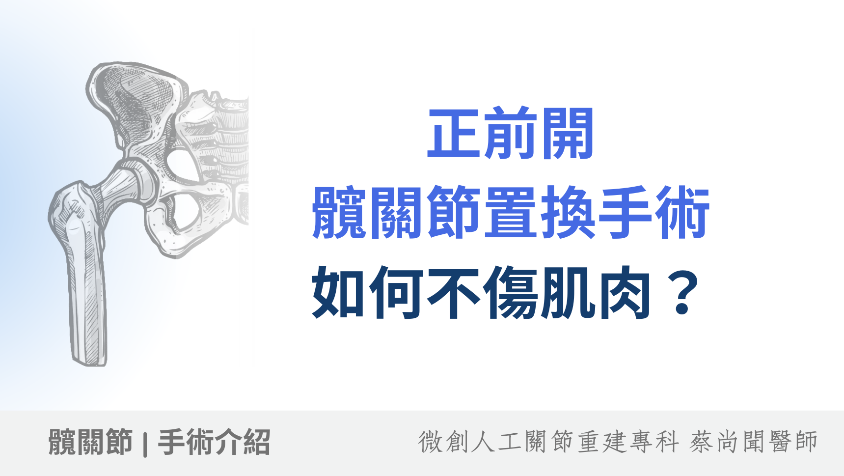 不傷肌肉的正前開髖關節手術：術後恢復快的首選