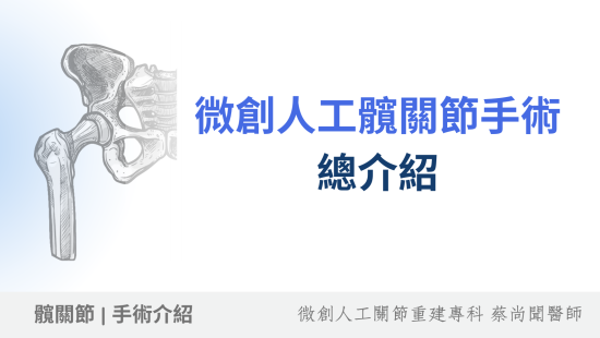 微創人工髖關節手術是什麼？帶你認識置換髖關節手術的新選擇！