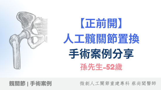 【正前開】微創人工髖關節置換手術-病患手術案例57歲孫先生分享