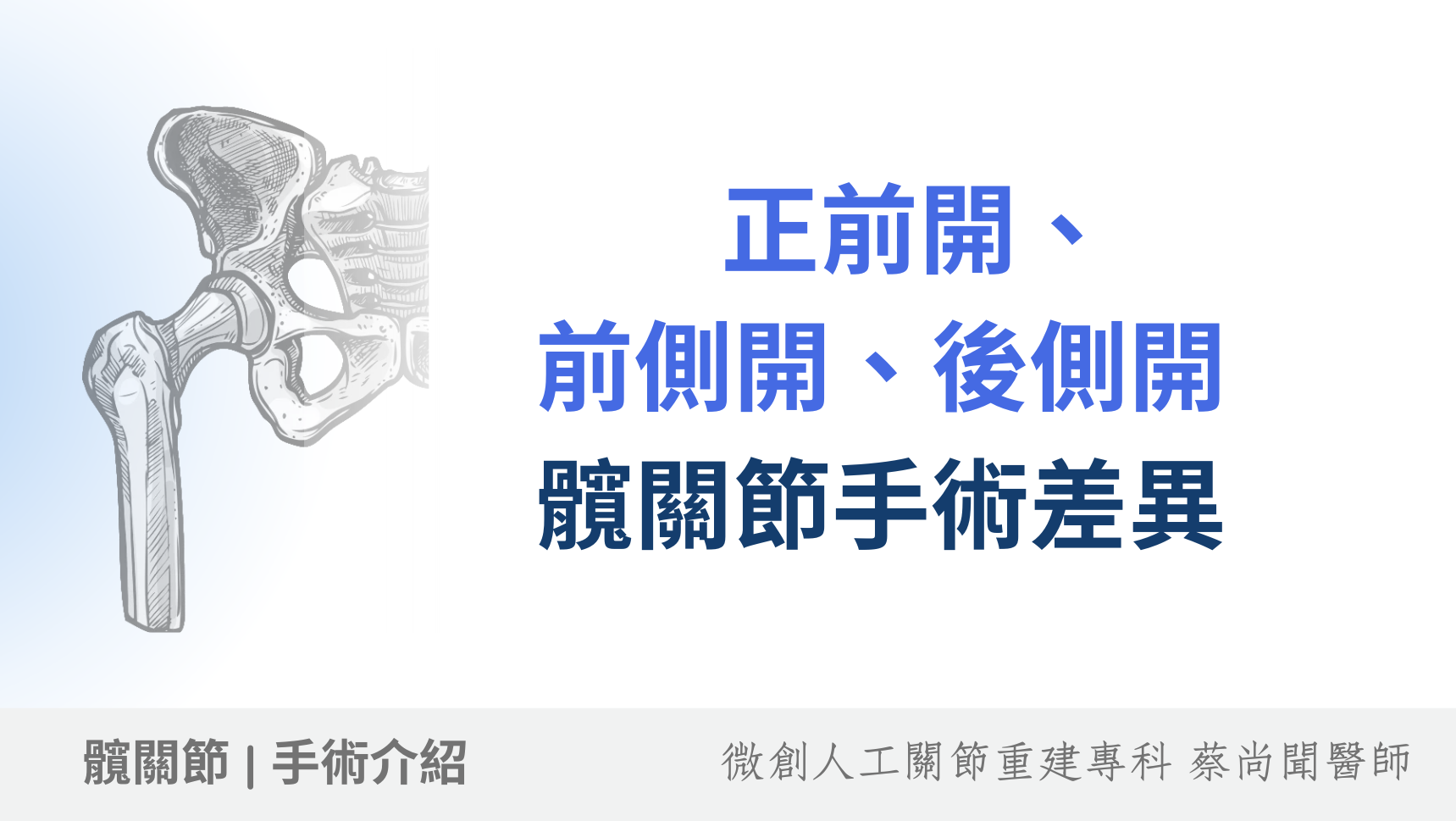 髖關節置換手術：正前開、前側開、後側開有什麼不同？進行手術前該知道的差異分析