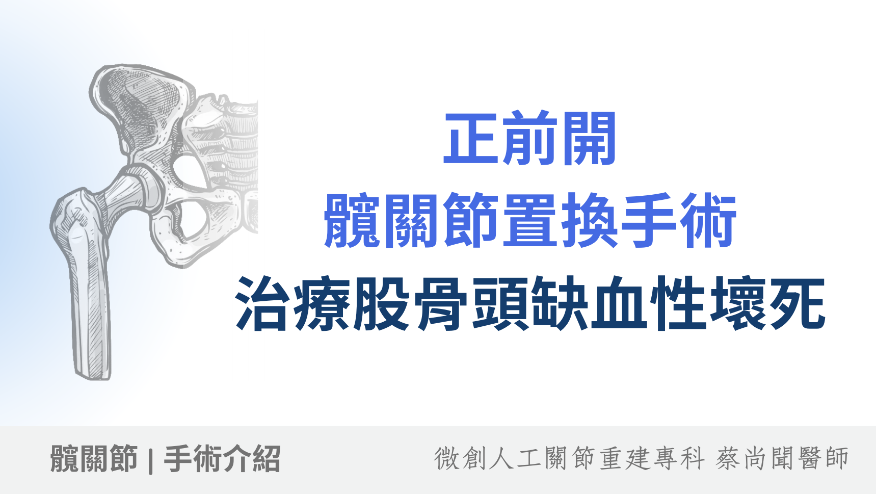 股骨頭缺血性壞死原因、症狀、常見的的治療選擇及手術費用：正前開髖關節手術