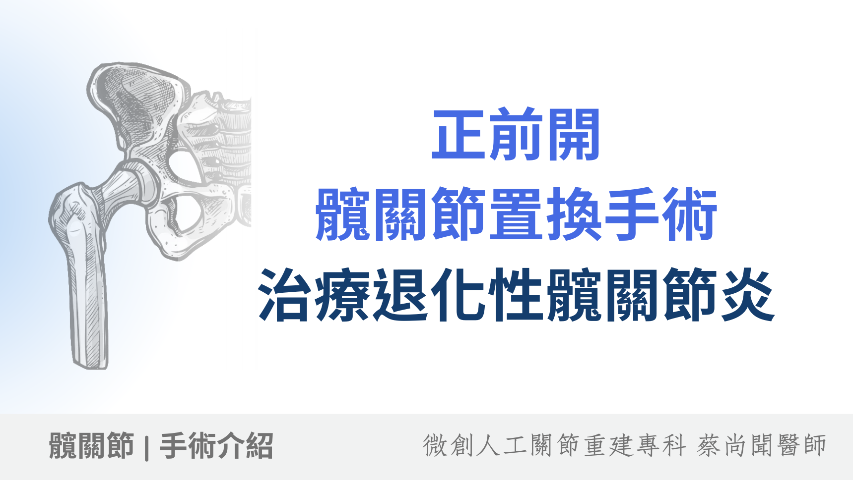 嚴重髖關節退化怎麼辦？談以正前開微創人工髖關節手術治療退化性髖關節炎